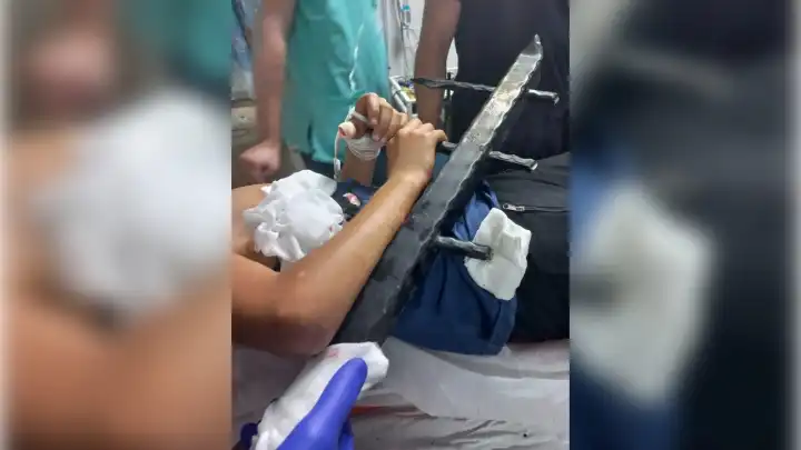 Vücuduna korkuluk demirleri saplanan çocuktan sevindirici haber