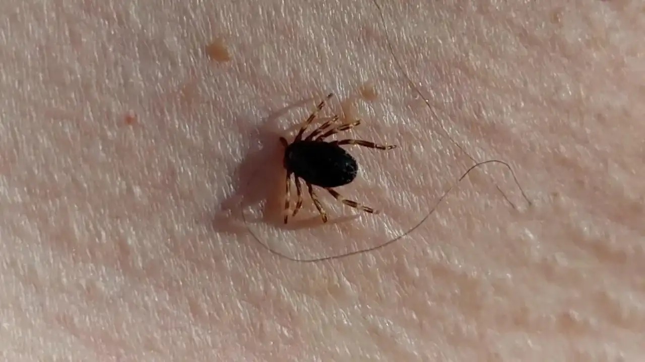 Piknikte, doğada, tarlada birebir… Keneler o kokuya dayanamıyor! Bu spreyle %100 koruma haberinin görseli