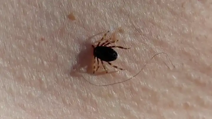 Piknikte, doğada, tarlada birebir… Keneler o kokuya dayanamıyor! Bu spreyle %100 koruma