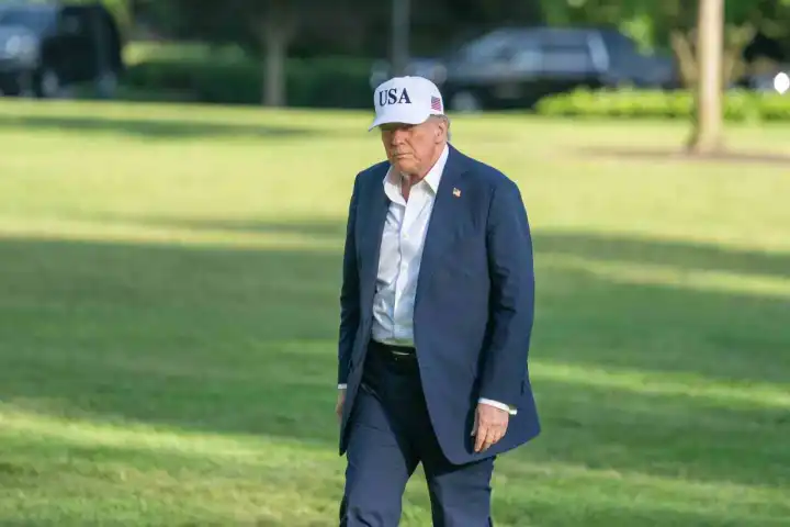 Trump’a kronik venöz yetmezlik teşhisi konuldu
