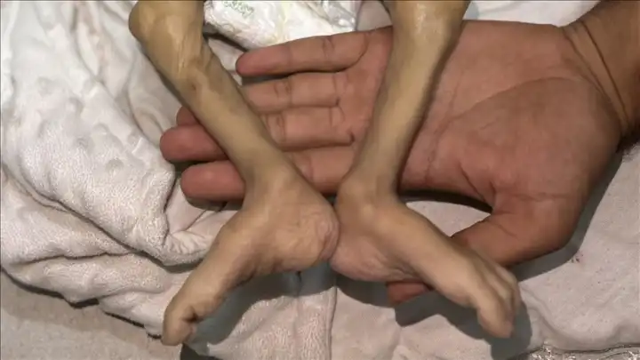 Filistin açlıkla mücadele ediyor: 6 kişi daha can verdi 