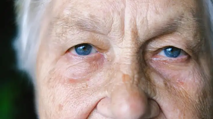 30 yaşında başlıyor, 50'de çöküyor: Bedeniniz sizden gizli yaşlanıyor!