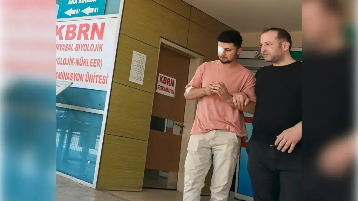 Bursa&#039;da mobilya işçisinin gözüne çivi saplandı haberinin görseli
