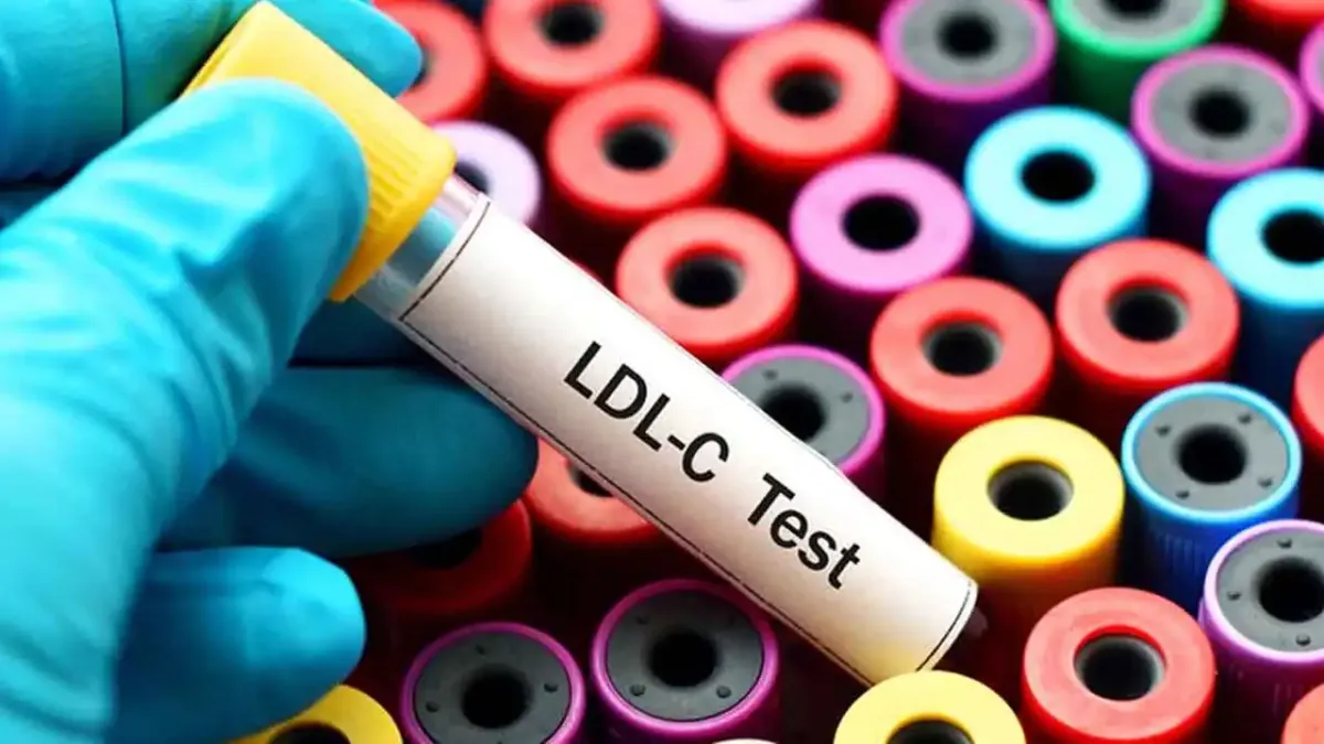 Kolesterolünüz yüksekse bu 4 değişiklik hayat kurtarabilir haberinin görseli