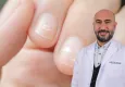 Tırnaklar sağlığınız hakkında uyarıyor: Bu belirtileri ihmal etmeyin