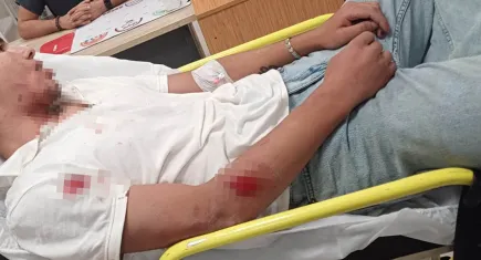 Magandalar dur durak bilmiyor: 'Ne bakıyorsun' kavgası hastanelik etti