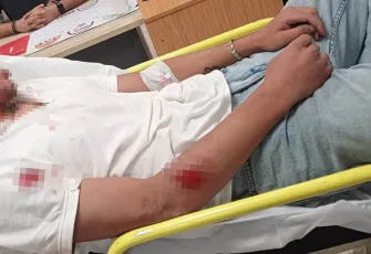 Magandalar dur durak bilmiyor: 'Ne bakıyorsun' kavgası hastanelik etti