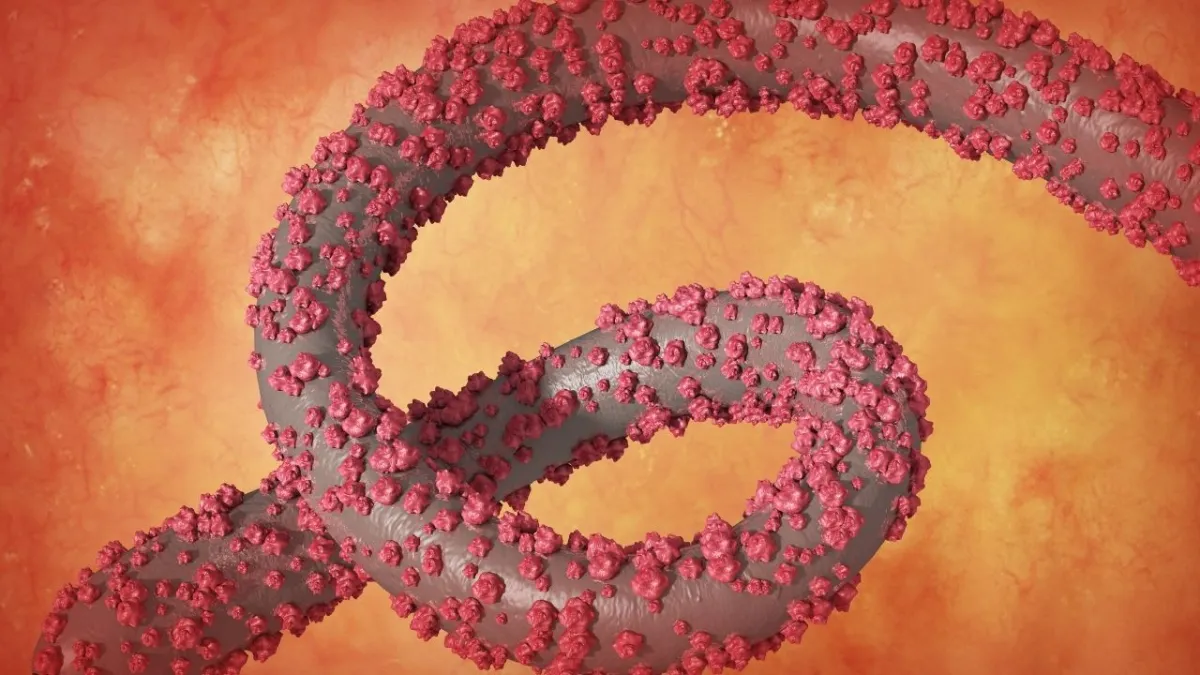 Kongo&#039;da ebola alarmı: 28 vaka, 15 ölü! Sağlık çalışanları da hedefte haberinin görseli