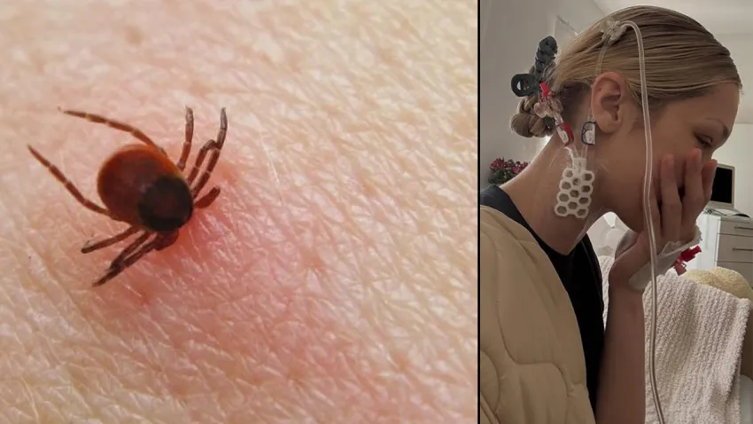 lyme
