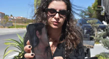 28 yaşındaki kadın eski sevgilisi tarafından sokak ortasında darbedildi