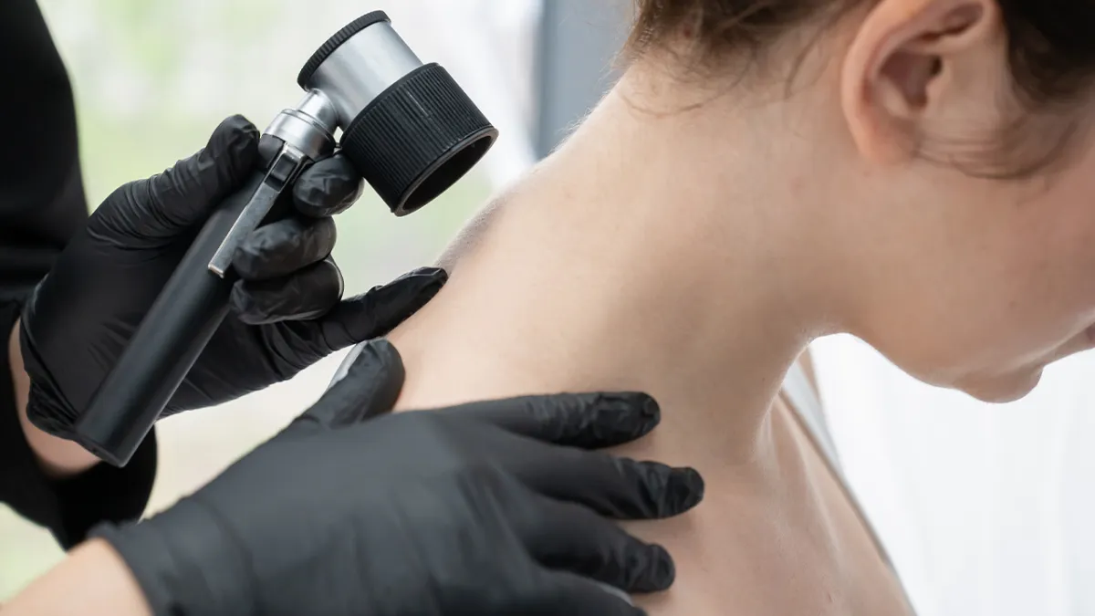 Cildiniz sinyal veriyor olabilir: Yaz sonrası cilt check-up’ını ihmal etmeyin haberinin görseli