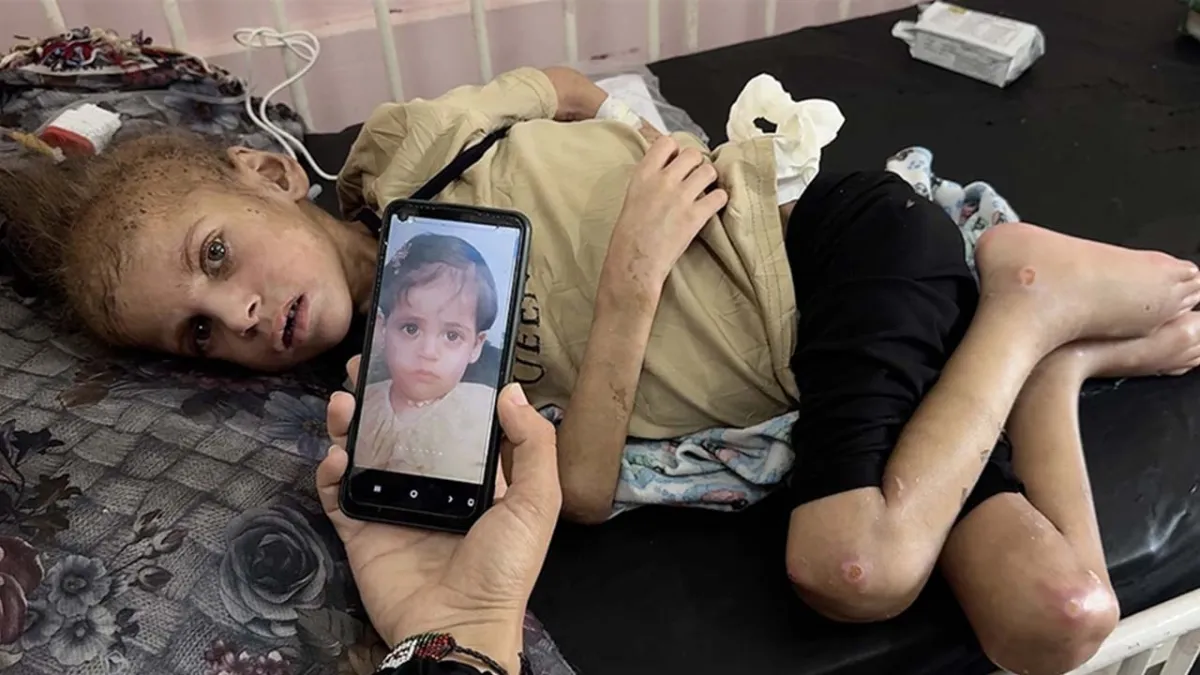 İsrail’in Gazze ablukası 7 yaşındaki May’i yatağa mahkum etti haberinin görseli