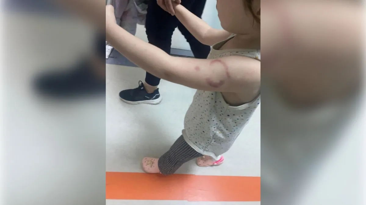 Edirne’de Özel Kreşte Skandal: 3 Yaşındaki Çocuğu Öğretmen Isırdı İddiası haberinin görseli