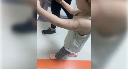 Edirne’de Özel Kreşte Skandal: 3 Yaşındaki Çocuğu Öğretmen Isırdı İddiası