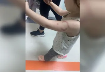 Edirne’de Özel Kreşte Skandal: 3 Yaşındaki Çocuğu Öğretmen Isırdı İddiası