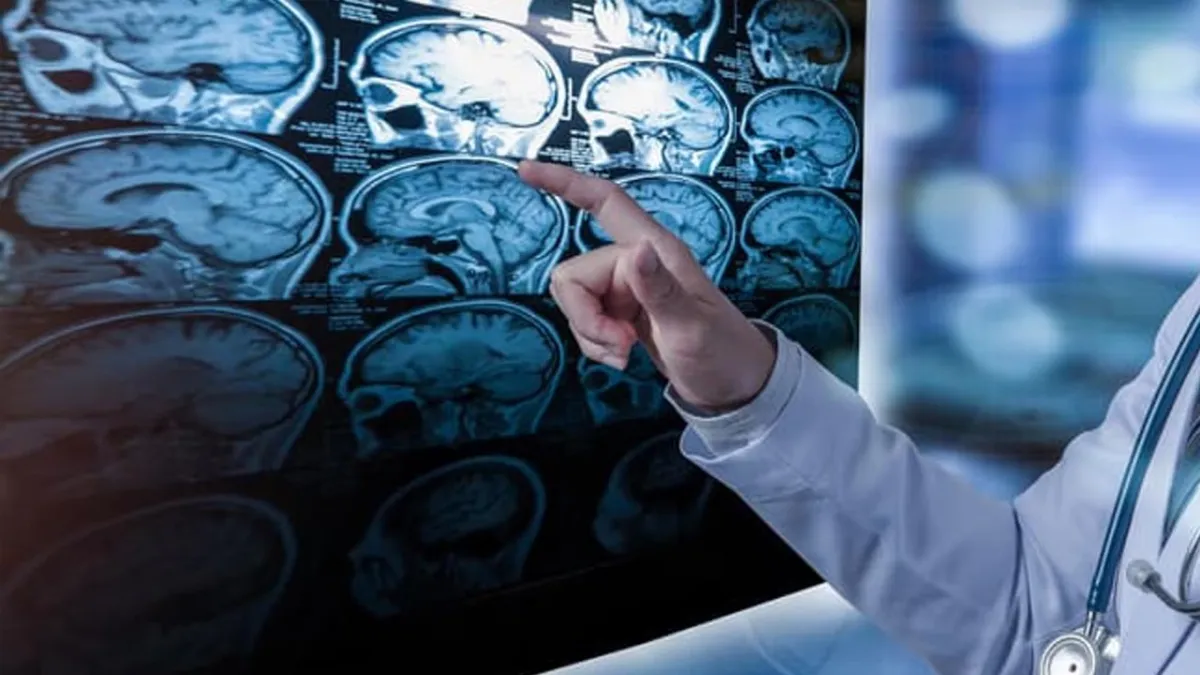 Bilim insanları yeni bir nörolojik hastalık keşfetti: Sadece 13 kişide rastlandı haberinin görseli