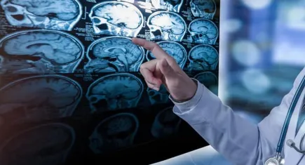 Bilim insanları yeni bir nörolojik hastalık keşfetti: Sadece 13 kişide rastlandı