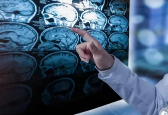 Bilim insanları yeni bir nörolojik hastalık keşfetti: Sadece 13 kişide rastlandı