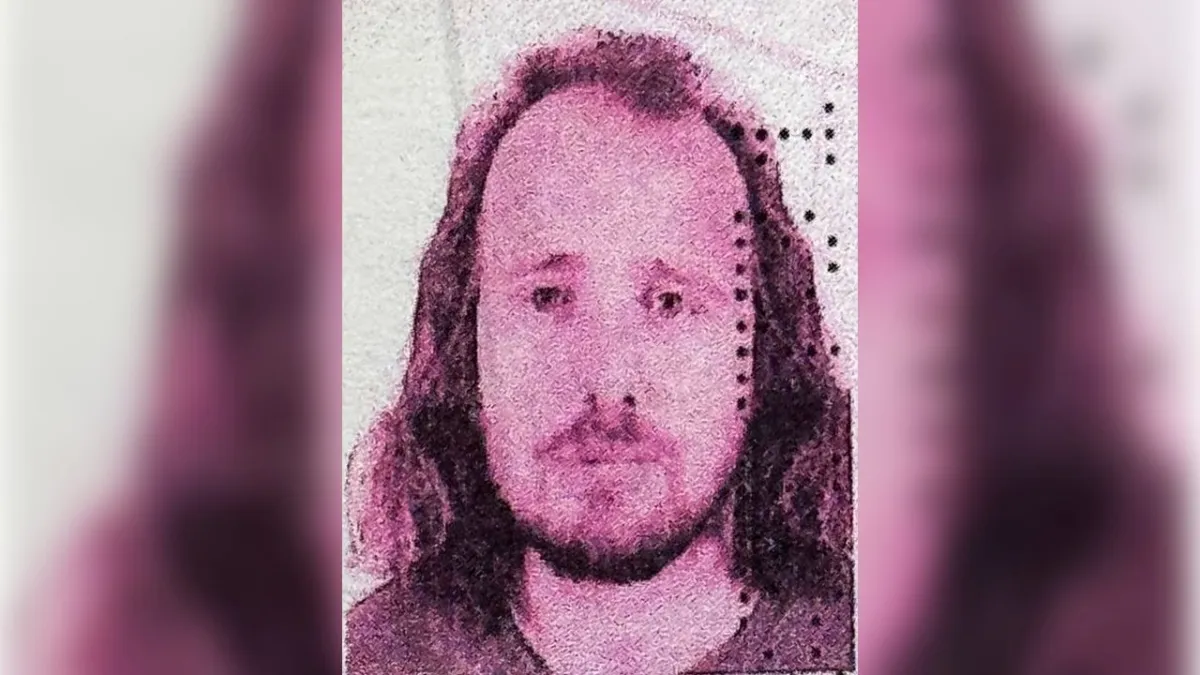 Saç ektirdikten sonra öldü haberinin görseli