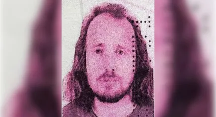 Saç ektirdikten sonra öldü