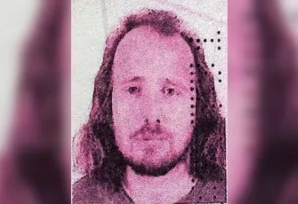 Saç ektirdikten sonra öldü