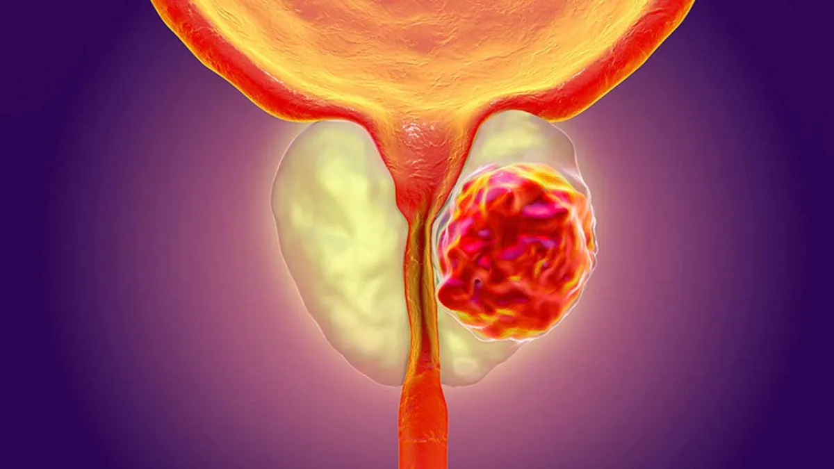 50 yaş üstü her erkek bu testi yaptırmalı! haberinin görseli