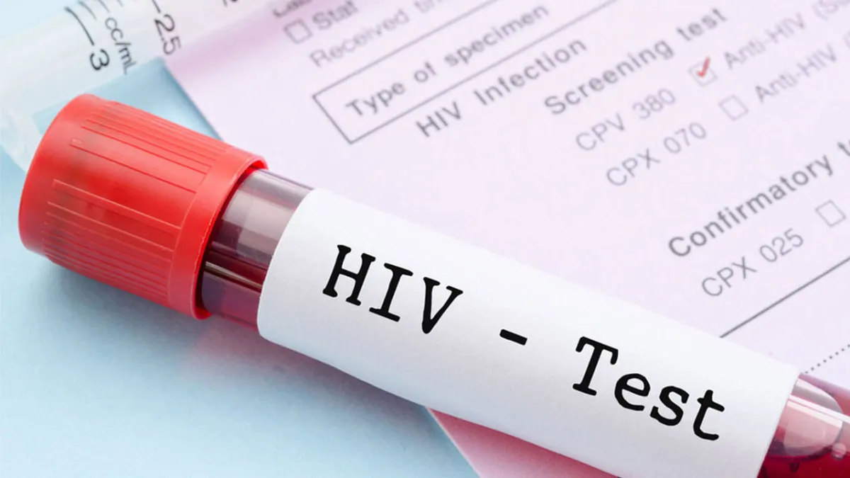 TTB’den Dünya AIDS Günü çağrısı: HIV öldürmez; bilgi eksikliği öldürür haberinin görseli