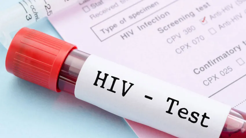 TTB’den Dünya AIDS Günü çağrısı: HIV öldürmez; bilgi eksikliği öldürür haberinin görseli