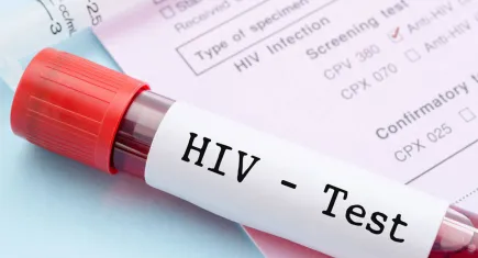 TTB’den Dünya AIDS Günü çağrısı: HIV öldürmez; bilgi eksikliği öldürür