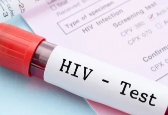 TTB’den Dünya AIDS Günü çağrısı: HIV öldürmez; bilgi eksikliği öldürür