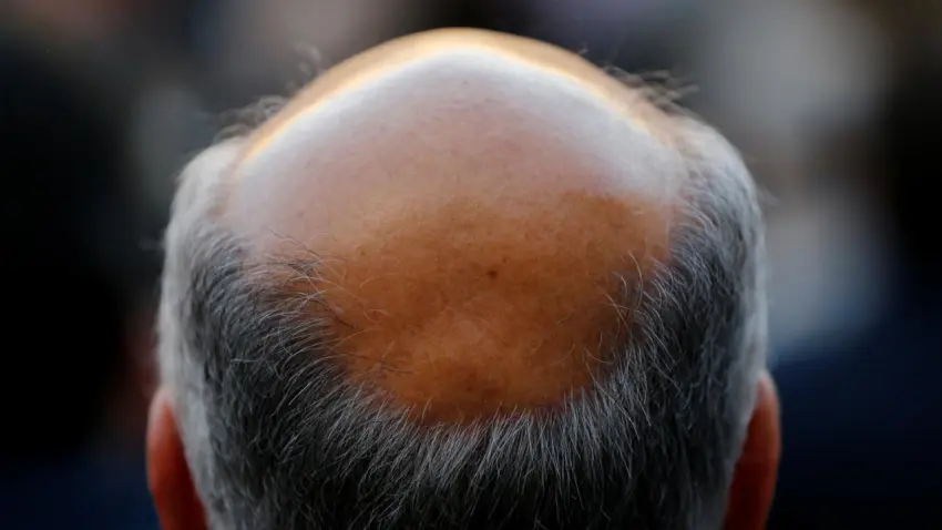 Erkek tipi kellikte devrim: Saç çıkarma oranı yüzde 539 arttı haberinin görseli