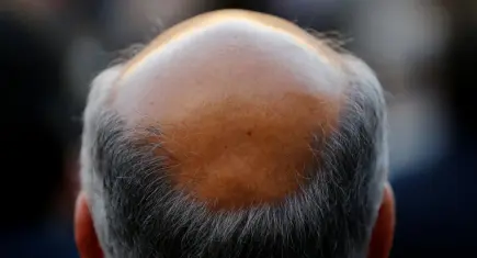 Erkek tipi kellikte devrim: Saç çıkarma oranı yüzde 539 arttı