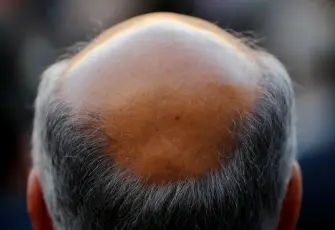 Erkek tipi kellikte devrim: Saç çıkarma oranı yüzde 539 arttı