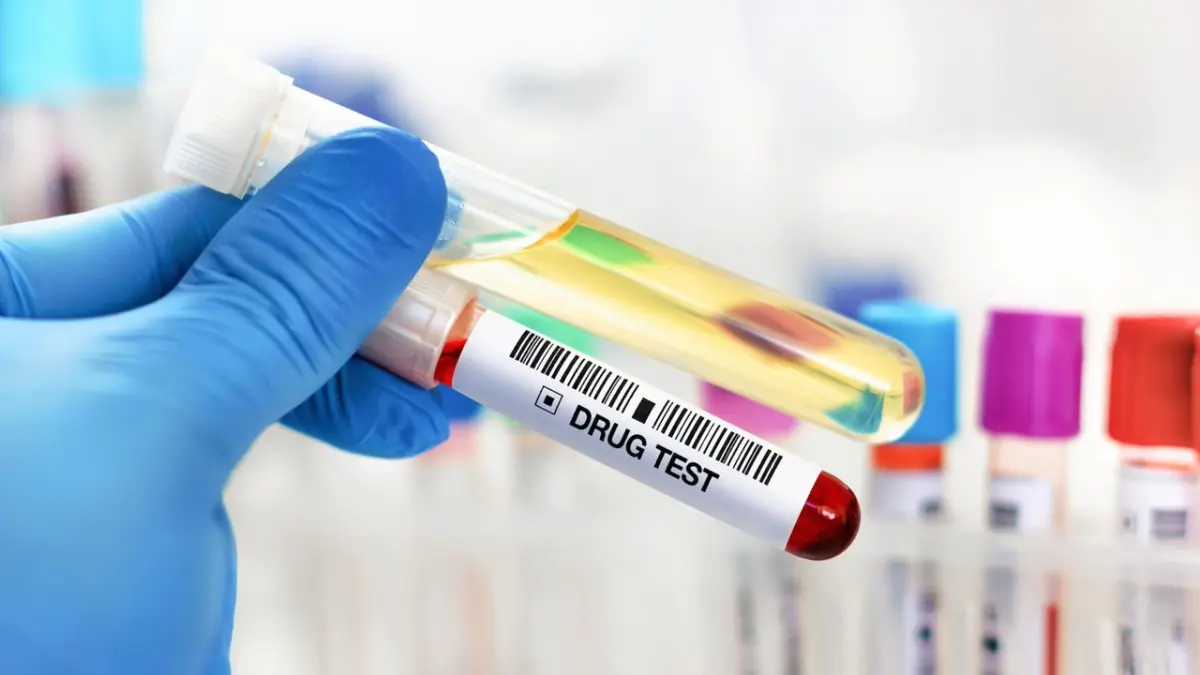 Saç boyatmak, tırnak kesmek… Uyuşturucu testlerini yanıltmak mümkün mü? Uzmanlar yanıtladı haberinin görseli