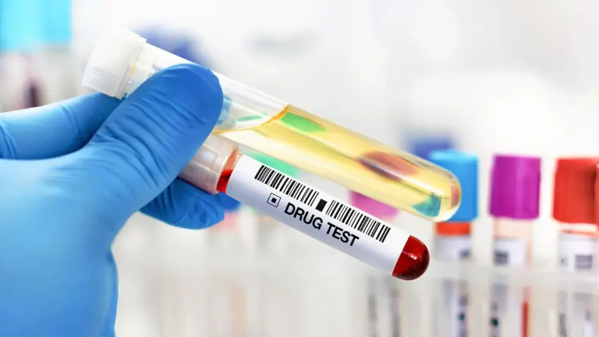 Saç boyatmak, tırnak kesmek… Uyuşturucu testlerini yanıltmak mümkün mü? Uzmanlar yanıtladı