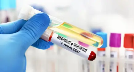 Saç boyatmak, tırnak kesmek… Uyuşturucu testlerini yanıltmak mümkün mü? Uzmanlar yanıtladı