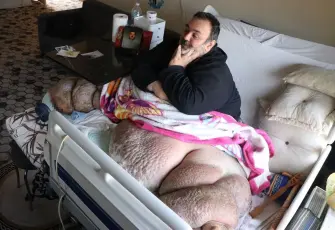 Fil hastalığı yatağa mahkum etti: En büyük özlemi eşiyle kol kola yürüyebilmek