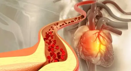 Kötü kolesterol gençleri de tehdit ediyor