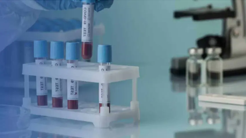 Kış aylarında sağlığı korumak için check-up önemli