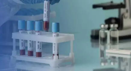 Kış aylarında sağlığı korumak için check-up önemli