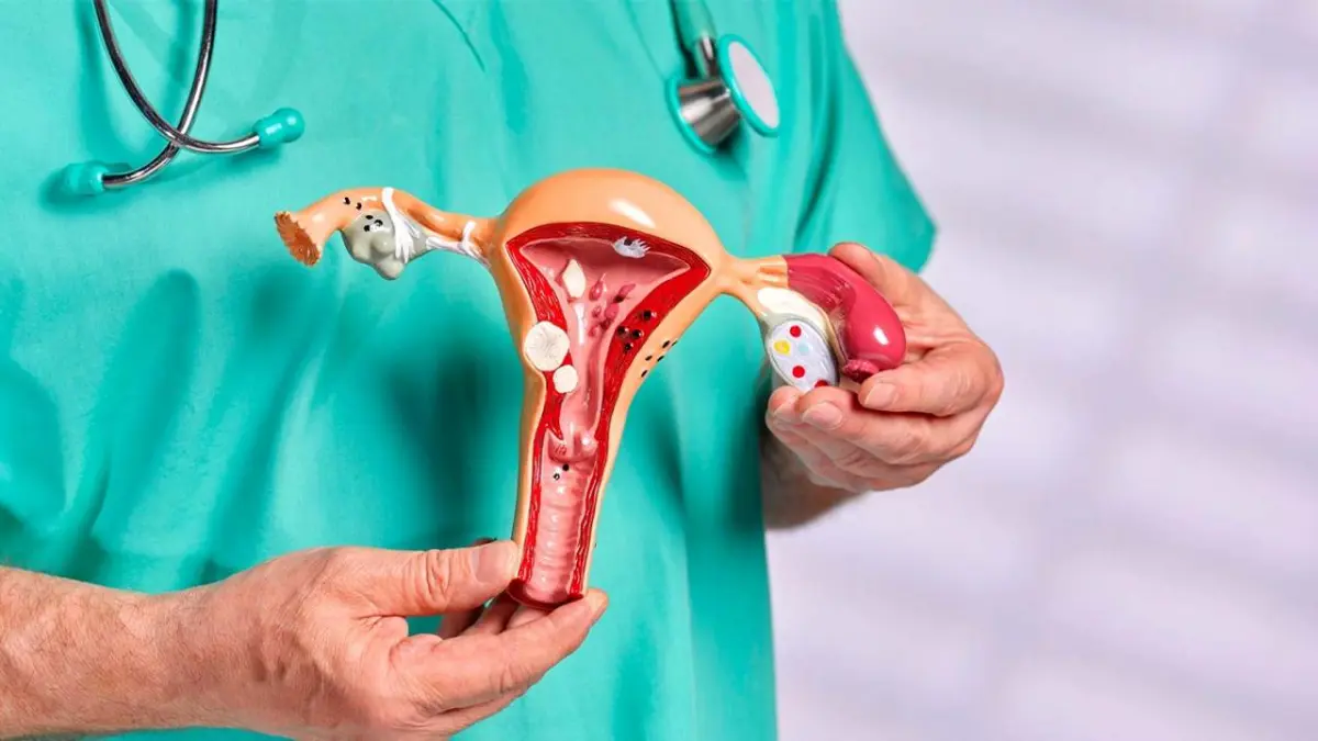 Rahim ağzı kanseri erken tanıyla önlenebilir haberinin görseli