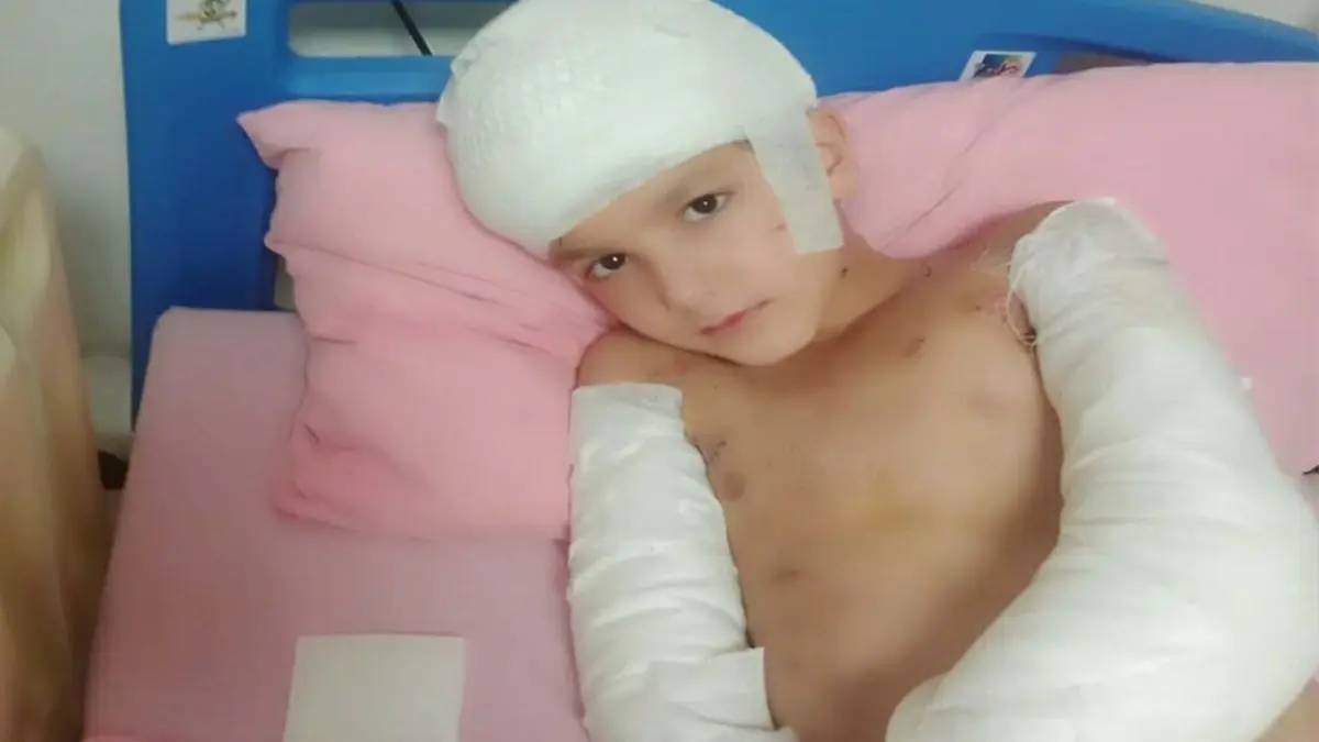 Sokak köpekleri saldırısında yaralanan Tunahan’ın ailesine 5 milyon TL manevi tazminat haberinin görseli