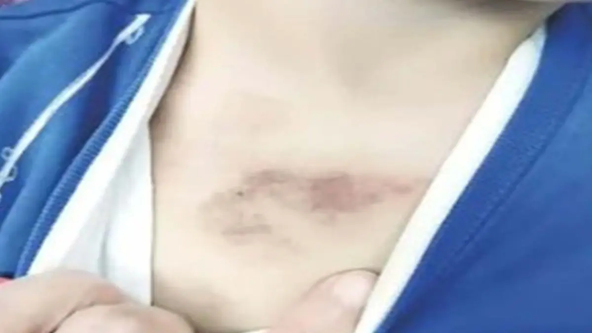 İBB kreşindeki istismar iddiasına bakanlık el koydu haberinin görseli