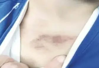 İBB kreşindeki istismar iddiasına bakanlık el koydu