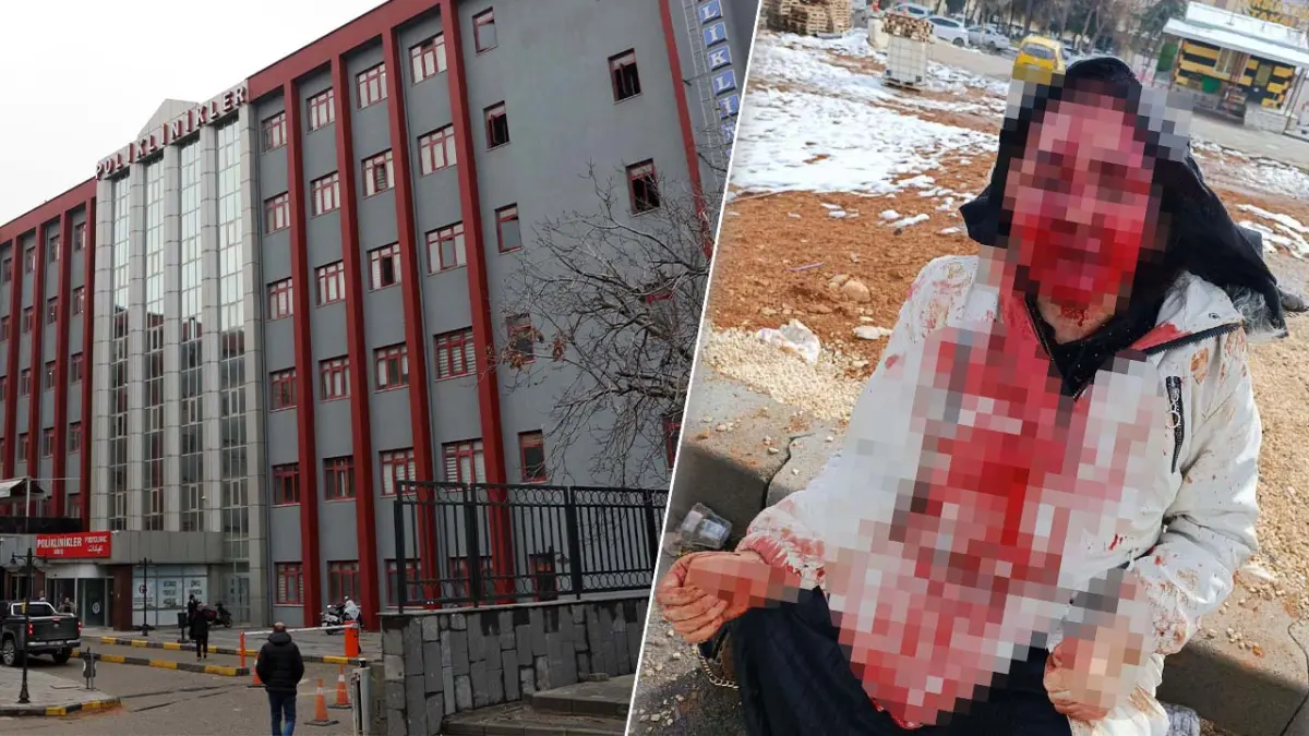 Gaziantep'te erkek şiddeti: Boşanma aşamasındaki eşini kaldırım taşıyla dövdü haberinin görseli