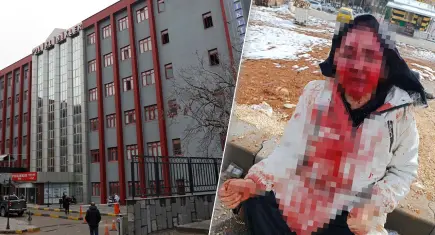 Gaziantep'te erkek şiddeti: Boşanma aşamasındaki eşini kaldırım taşıyla dövdü