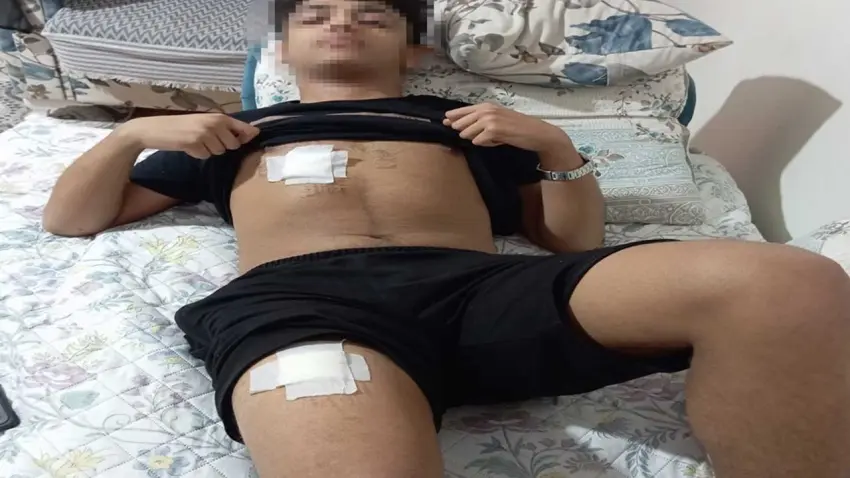 Adana’da parkta kanlı "Mesaj" kavgası: 15 yaşındaki çocuk bıçaklandı! haberinin görseli