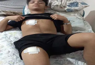 Adana’da parkta kanlı "Mesaj" kavgası: 15 yaşındaki çocuk bıçaklandı!