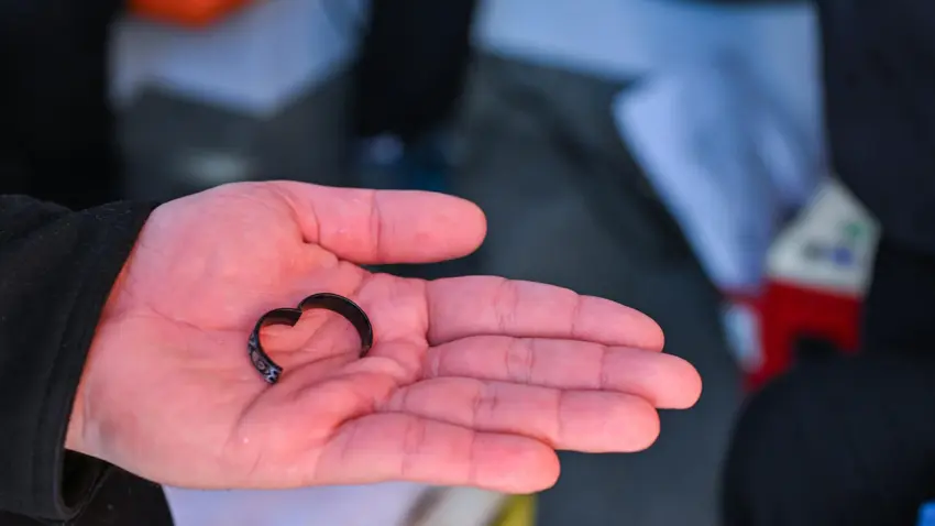 yüzük sıkışması