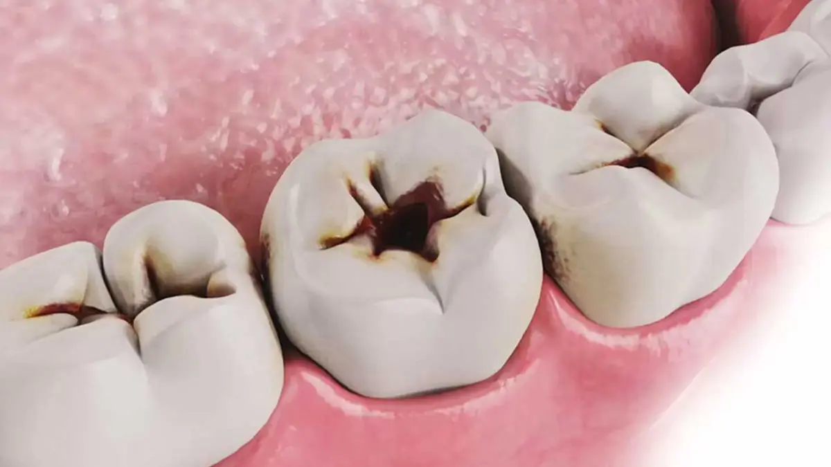 Ege Üniversitesi’nden diş sağlığında dijital buluş haberinin görseli